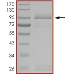 EGFR (T790M L792H L858R), Active